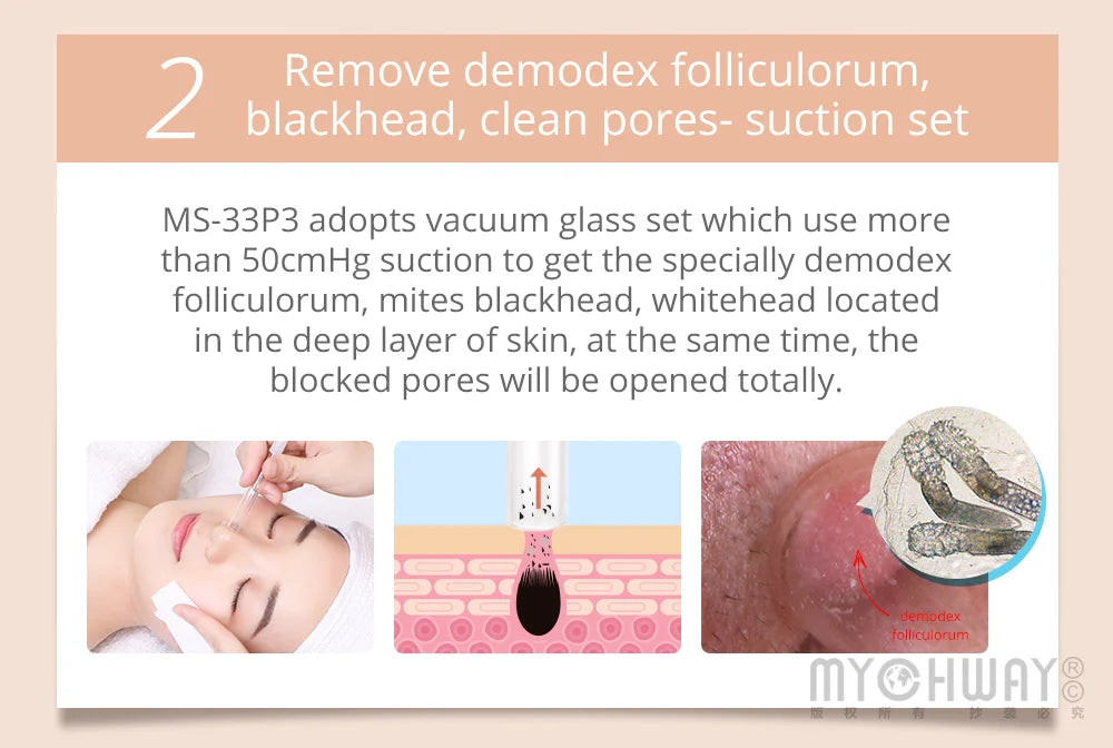 Mychway 3 In 1 Ultrasound Dermabrasion Beauty Skin Care Device